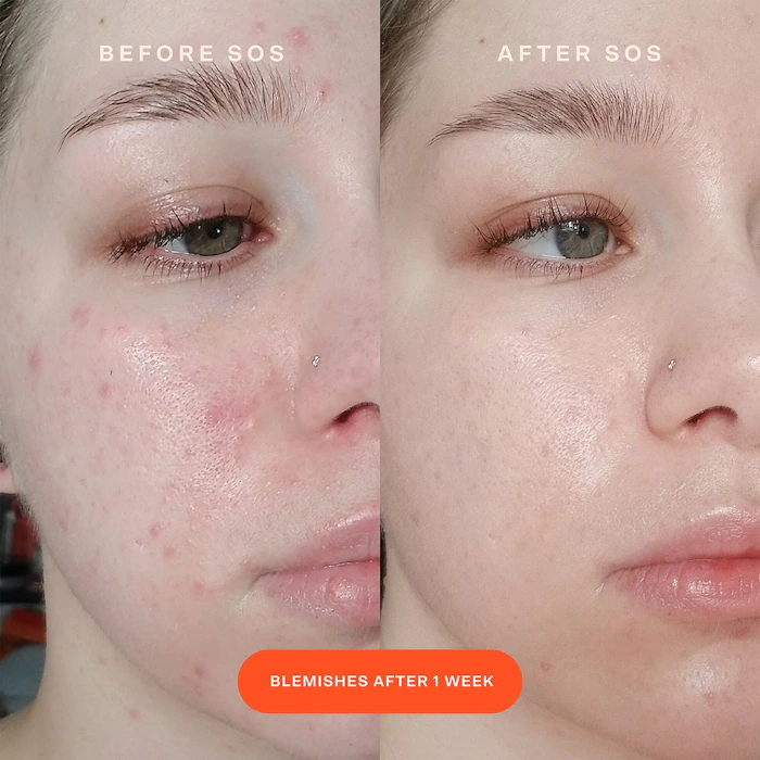 SOS Intensive Redness Relief Serum - Imagen 2