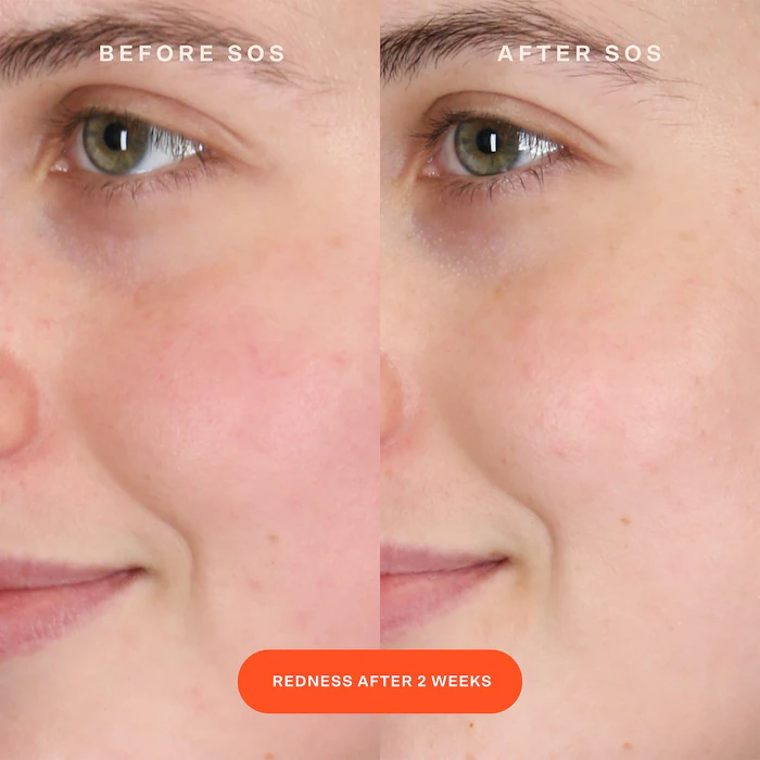 SOS Intensive Redness Relief Serum - Imagen 9
